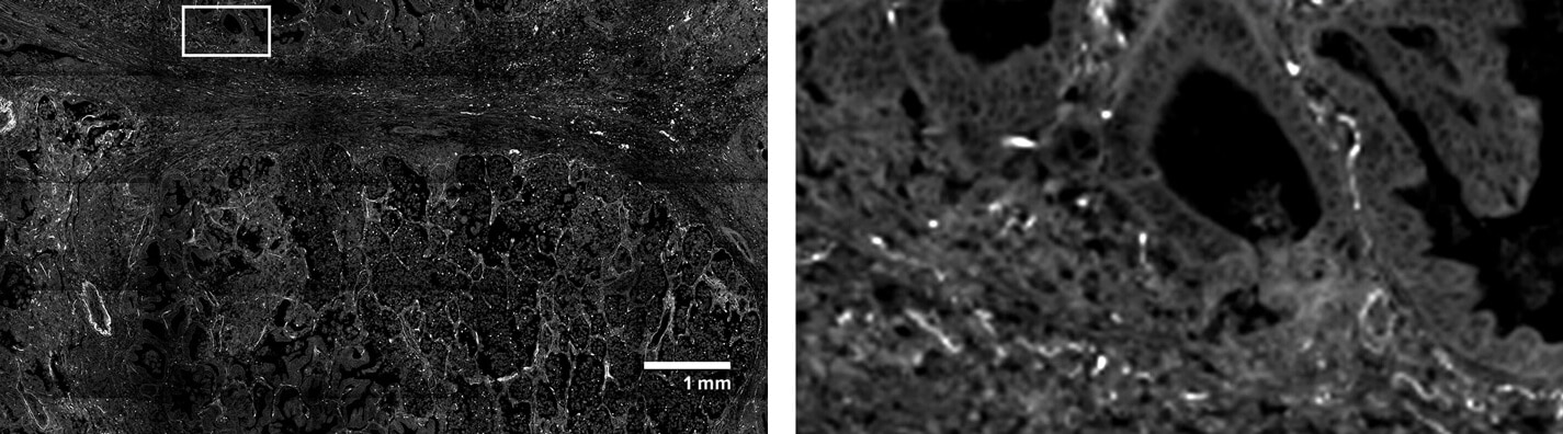 CosMx SMI Overview - Single-Cell Imaging - NanoString