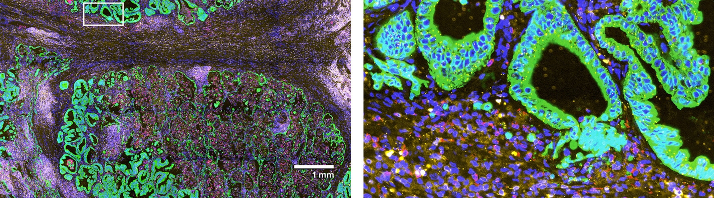 CosMx SMI Overview - Single-Cell Imaging - NanoString