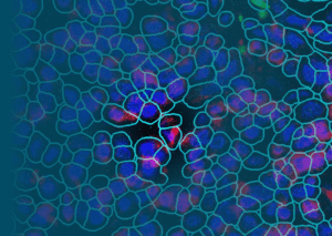 Green-outlined cells on a dark background, with pink/purple splotches in each cell