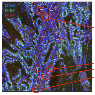 GeoMx DSP Spatial Genomics Overview - NanoString