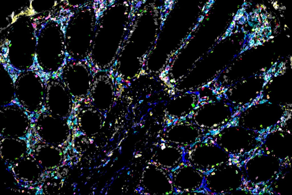 CosMx SMI Overview - Single-Cell Imaging - NanoString