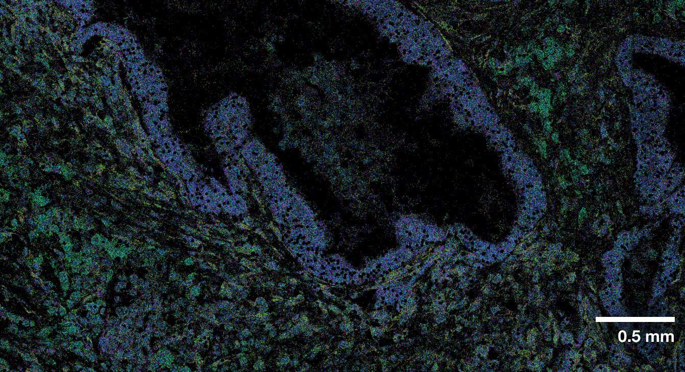 CosMx SMI Overview - Single-Cell Imaging - NanoString