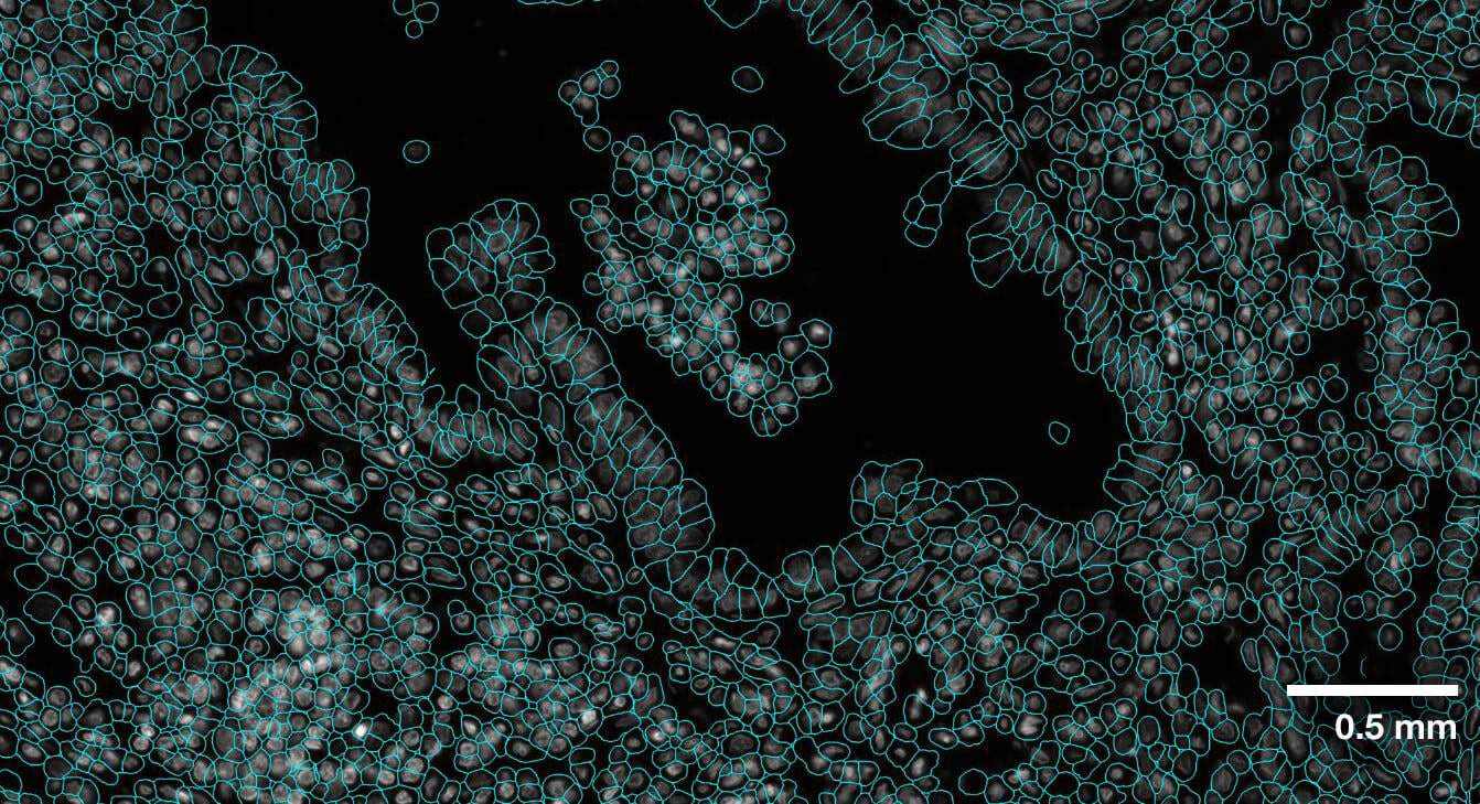 CosMx SMI Overview - Single-Cell Imaging - NanoString
